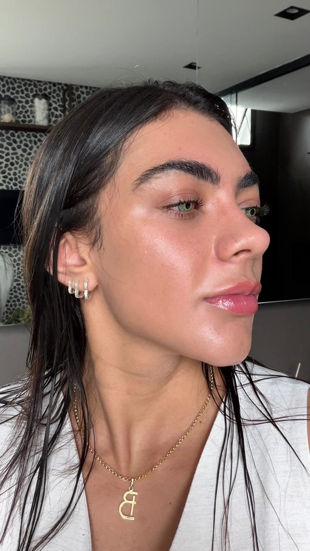 Dra. Brunna depois do Reface CO2 - Glow