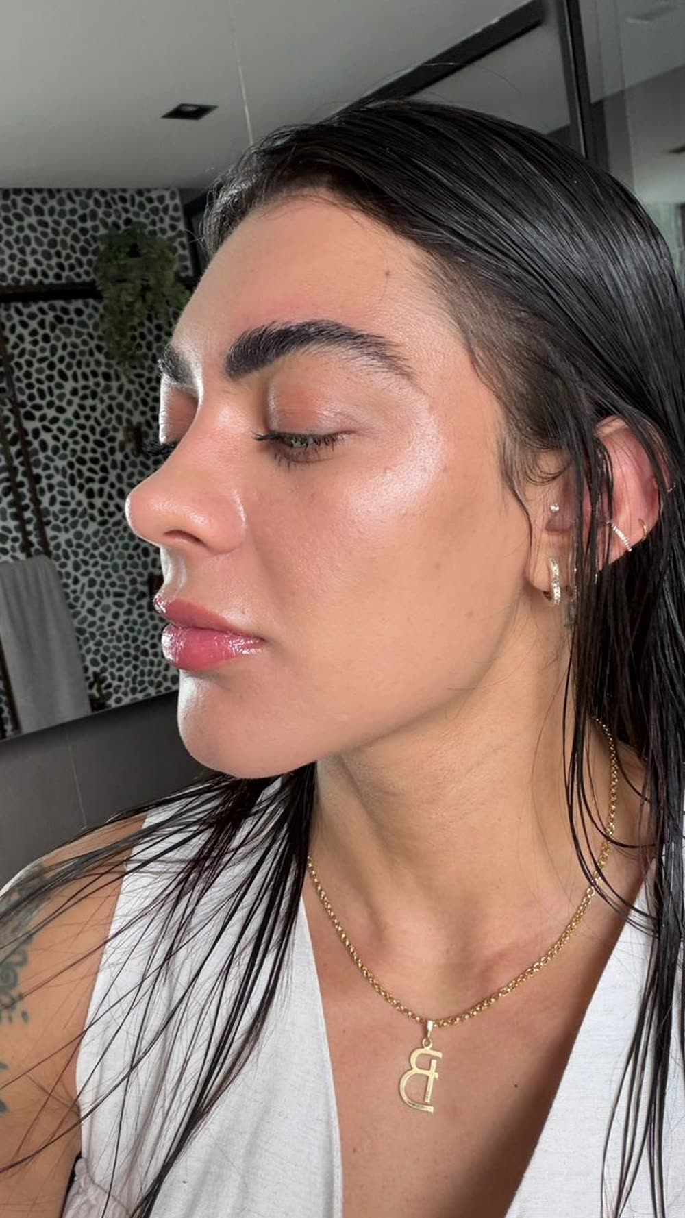 Dra. Brunna depois do Reface CO2 - Glow (lado oposto)